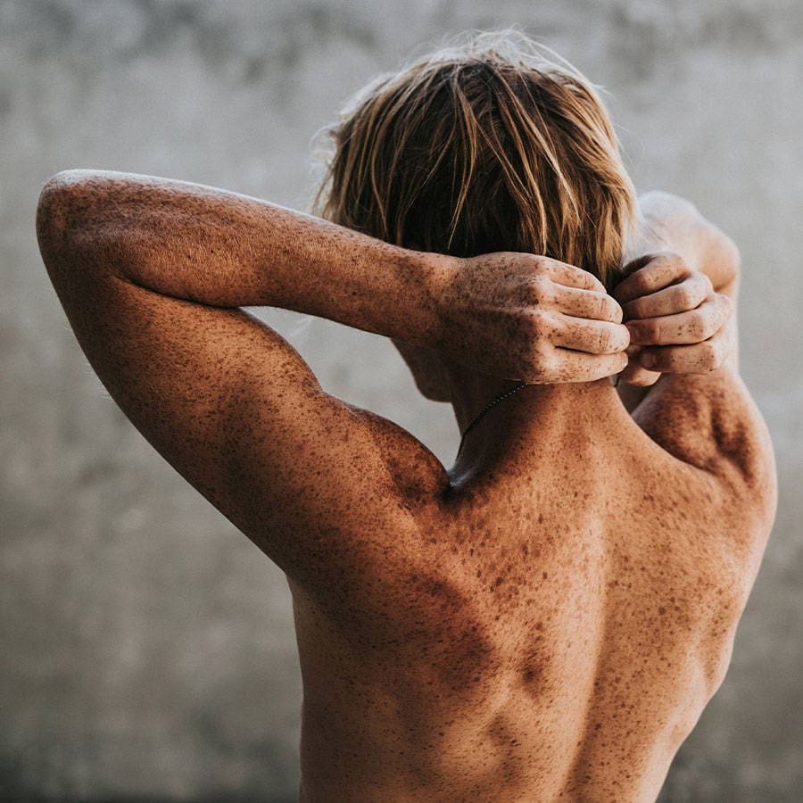 Treatments for excessive moles and other skin problems | The Mayfield Clinic