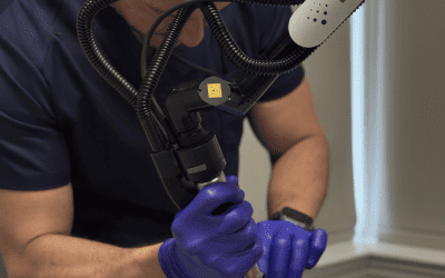 Erbium Laser Resurfacing vs CO₂ Laser: Benefits and Downtime